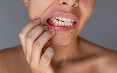 What Causes Advanced Gum Disease and When Surgery Becomes Necessary